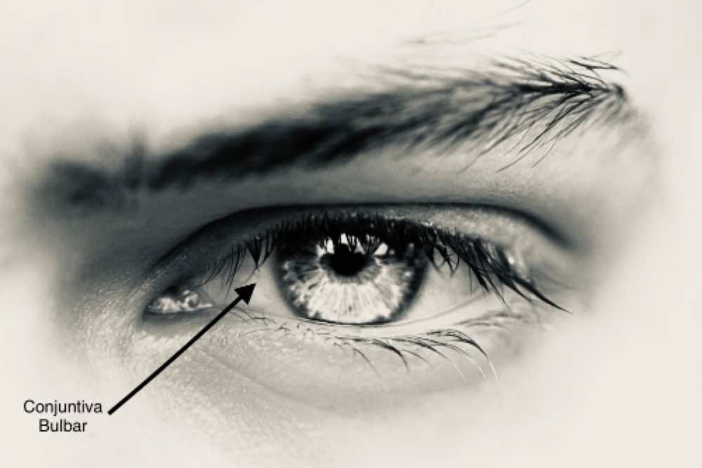 Conjuntiva bulbar 1