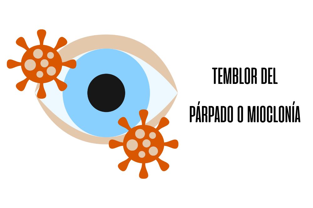 Temblor del parpado o mioclonía / Ojopedia