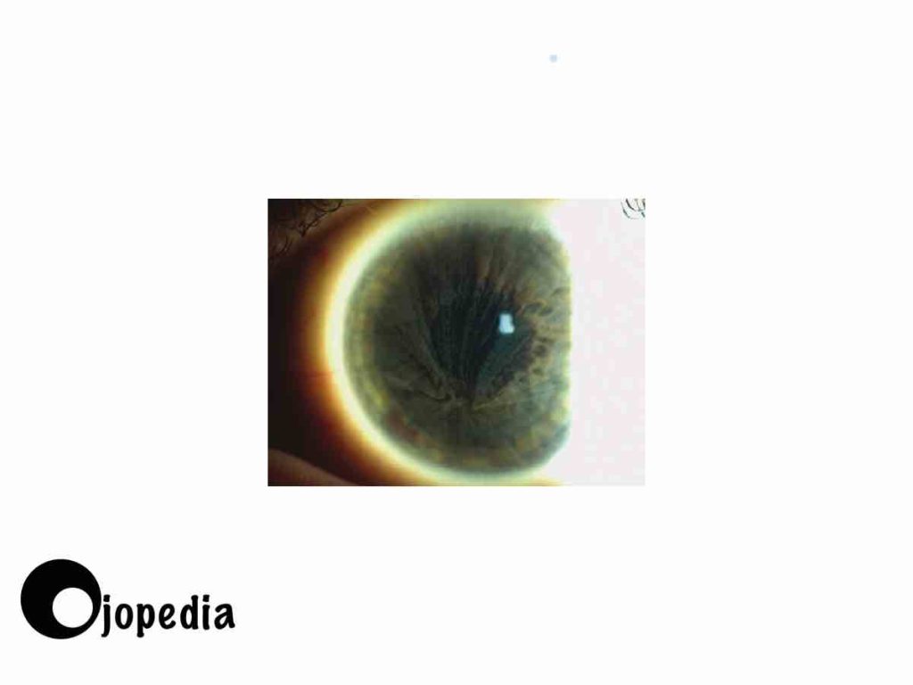 Imagen Cornea verticillata 1