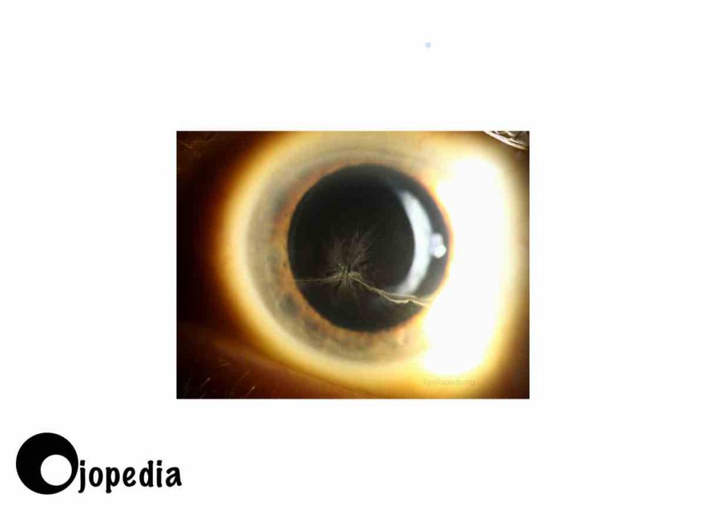Imagen Cornea verticillata 2