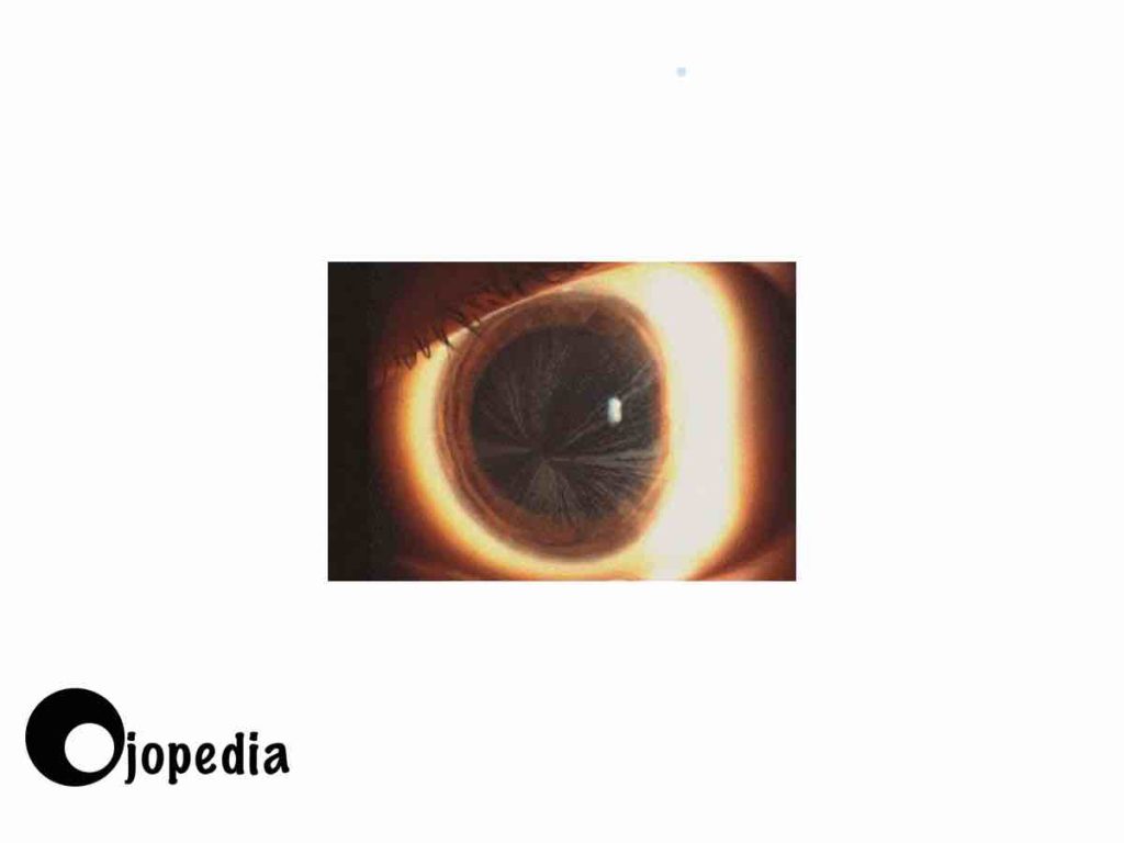 Imagen Cornea verticillata 3