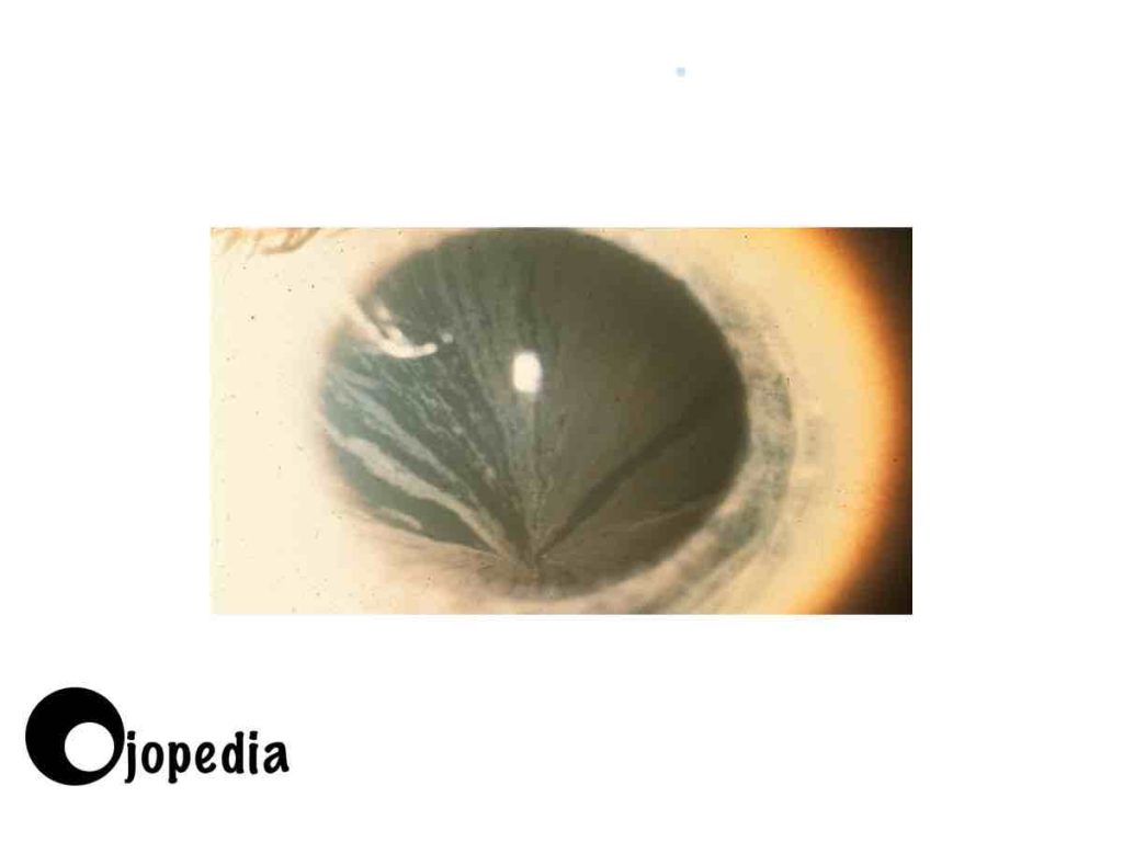 Imagen Cornea verticillata 4