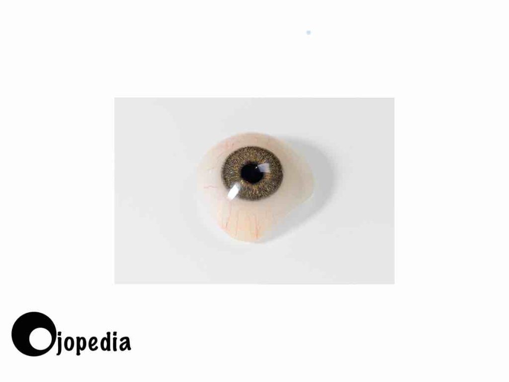 Imagen de la prótesis ocular