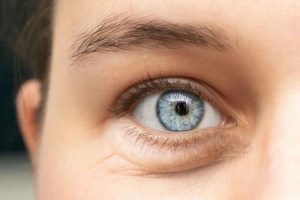 Bolsas en los ojos y tiroides: causas, síntomas y tratamientos