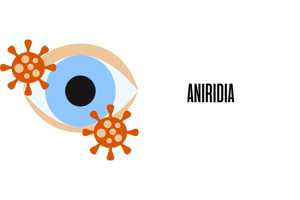 Aniridia / Ojopedia