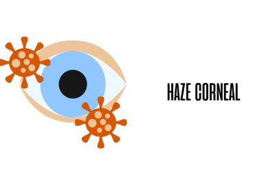Haze corneal / Ojopedia