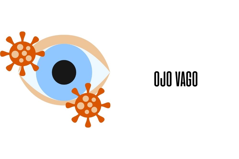 Ojo vago / Ojopedia