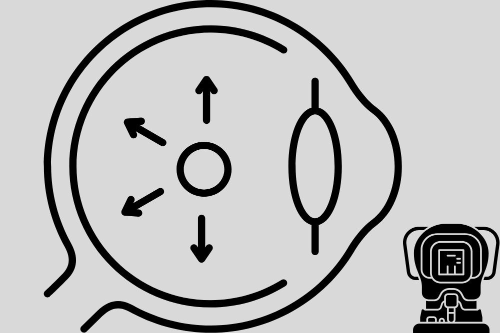 Presión intraocular / Ojopedia