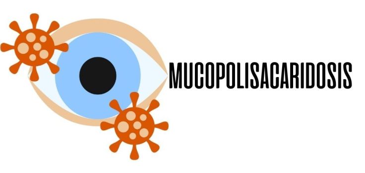 Mucopolisacaridosis / Ojopedia