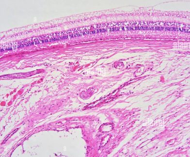 F92888E5-855B-4BCC-B477-5D363AFCDBCE